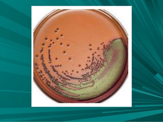 agar eosina y azul de metileno